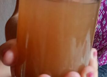 El Volcán: Niños con ronchas y gastroenteritis por el agua contaminada